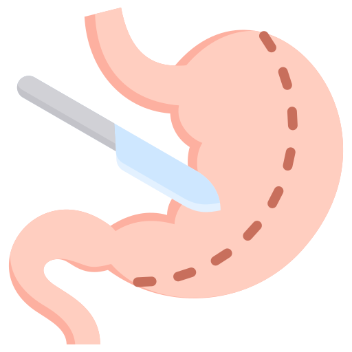 Bariatric Surgery
